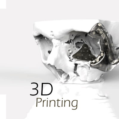 Stratasys, Renishaw & Metal 3D Printers